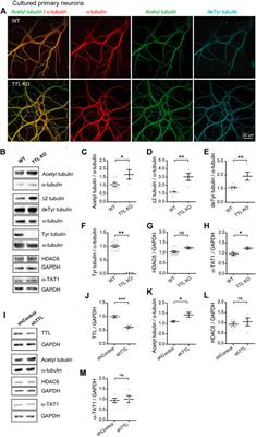 Crosstalk between acetylation and the tyrosination/detyrosination cycle of α-tubulin in Alzheimer’s disease